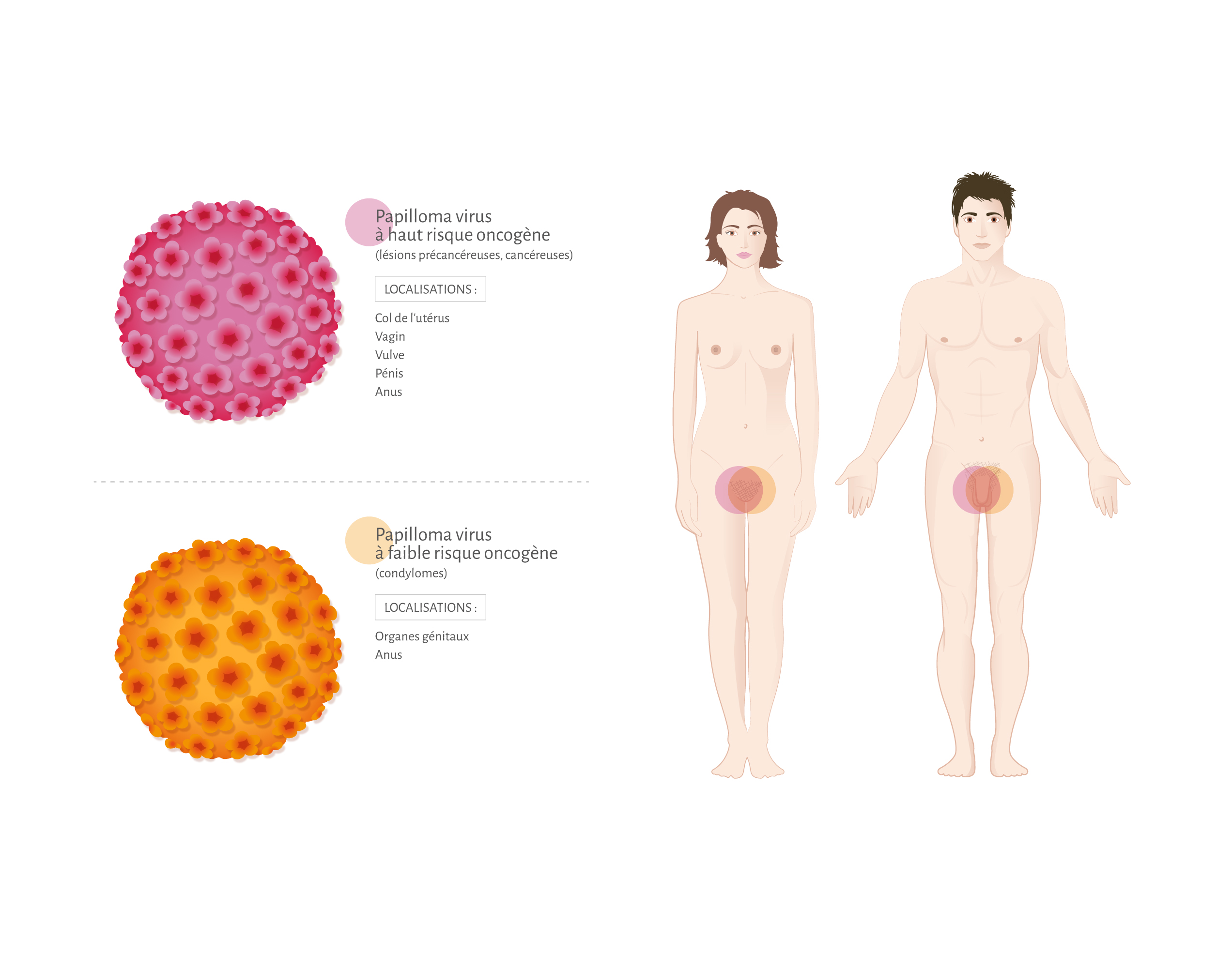 comment traiter papillomavirus chez l'homme