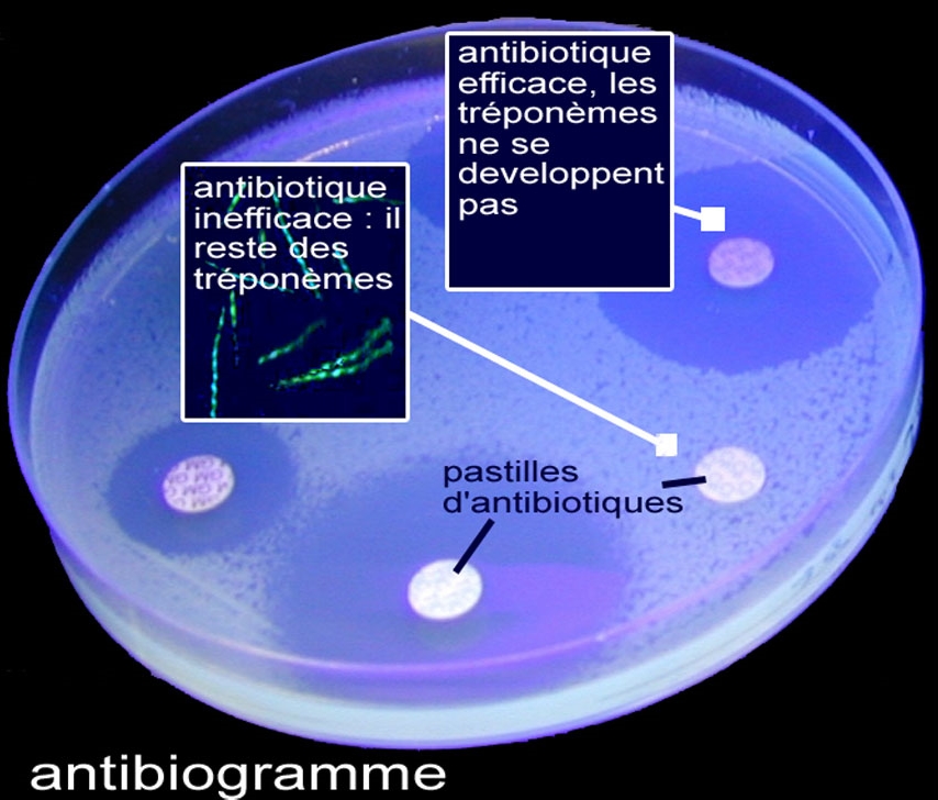 antibiogramme
