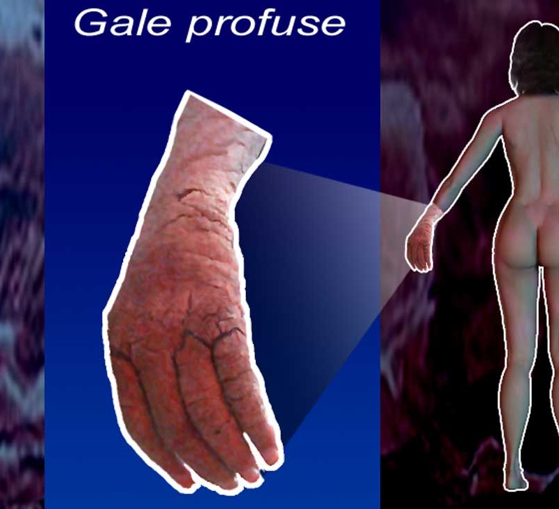 gale profuse